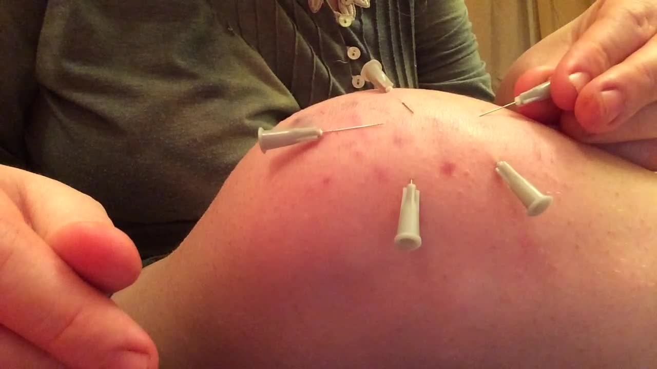 Extreme needle play fetish BBW