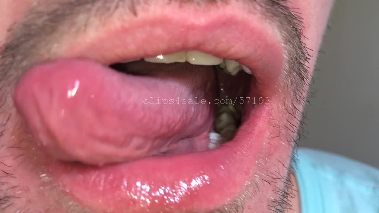 Caset Mouth Part6 Video2