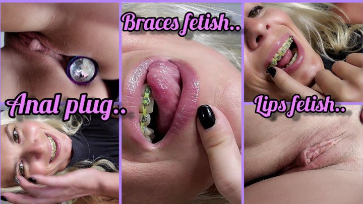 Licking And Sucking My Metal Braces/Anal Plug POV