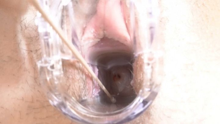 My Ovulation Cervix And Ovulation Gusset