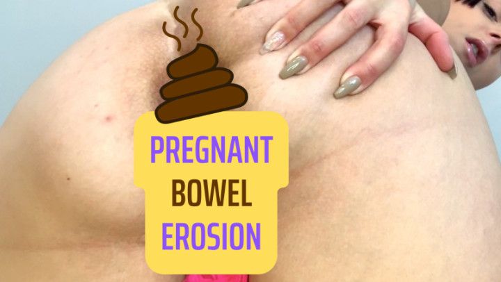 Pregnant Bowel Erosion