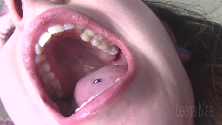 Hard Palate and Teeth