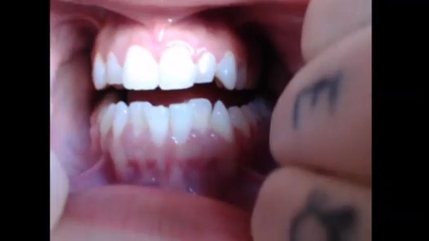 Natural Light Mouth Tour Pierced Tongue