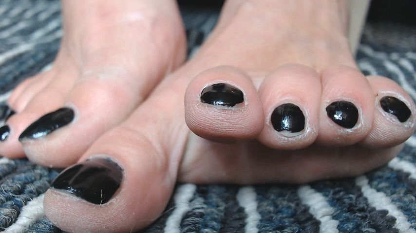 Black Toenails Closeup toe Play