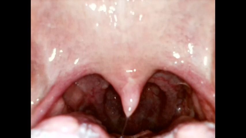 Close up of my throat coughing