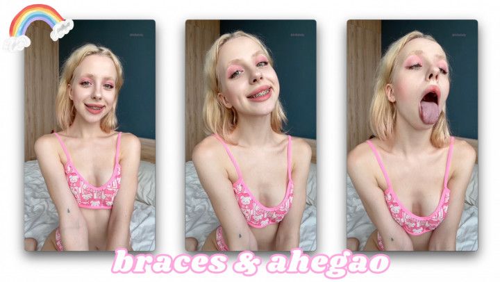 CUTE GF SHOWS BRACES AND AHEGAO