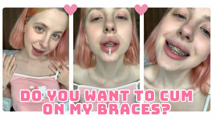 CUTE GF TEASES WITH BRACES