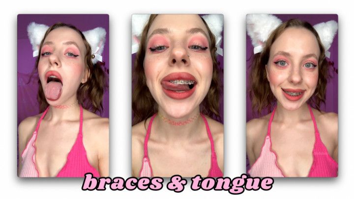 CATGIRL SHOWS YOU BRACES AND TONGUE