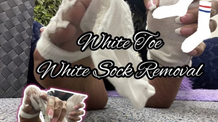 White Toe White Sock Removal