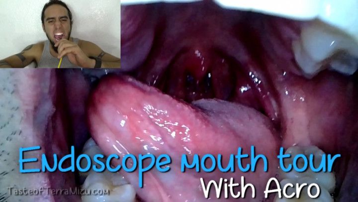 Endoscope Mouth Tour - Acro Suave