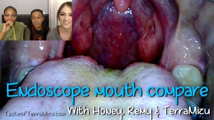 Endoscope Mouth Compare - Honey, Remy