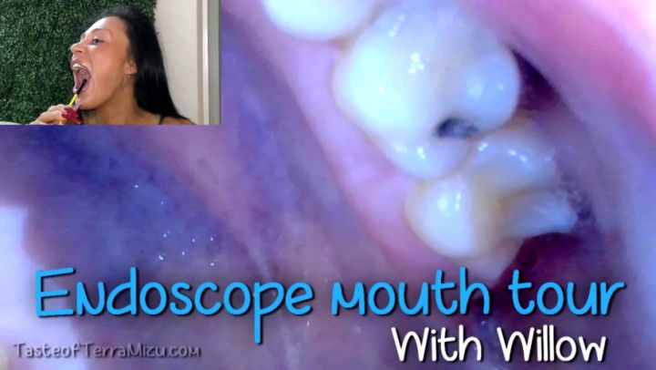 Endoscope Mouth Tour - Willow Lansky