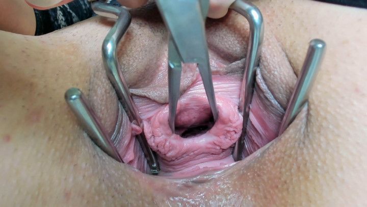 Medical Peehole Inspection