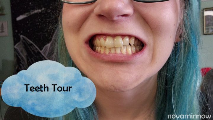 Teeth Tour