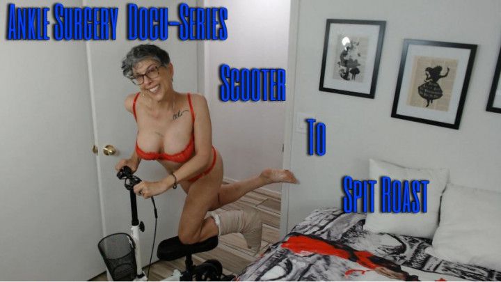 Ankle Surgery Docu-Series Scooter To Spit Roast