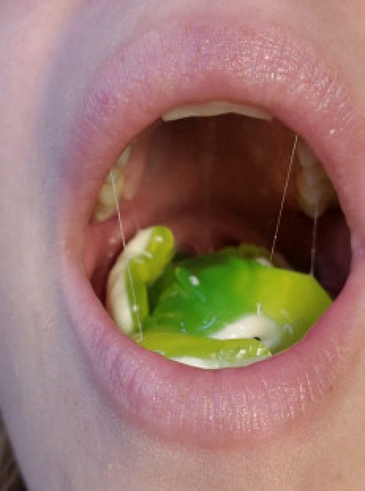 Open mouth swallowing two JUMBO gummy frogs