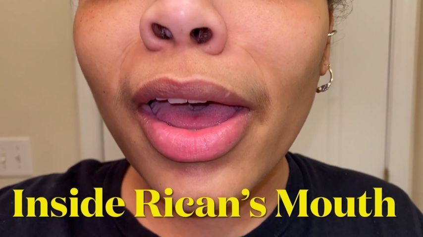 Inside Rican's Mouth