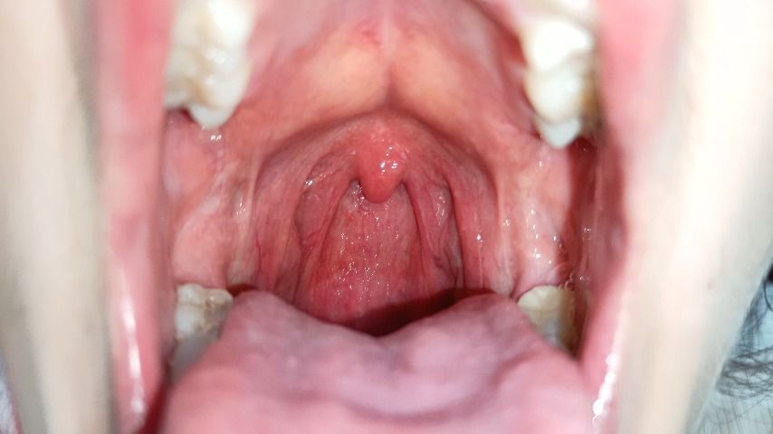 Close-up UVULA, THROAT fetish