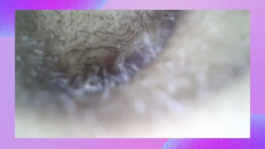 Cleaning my ear with my microscope camera