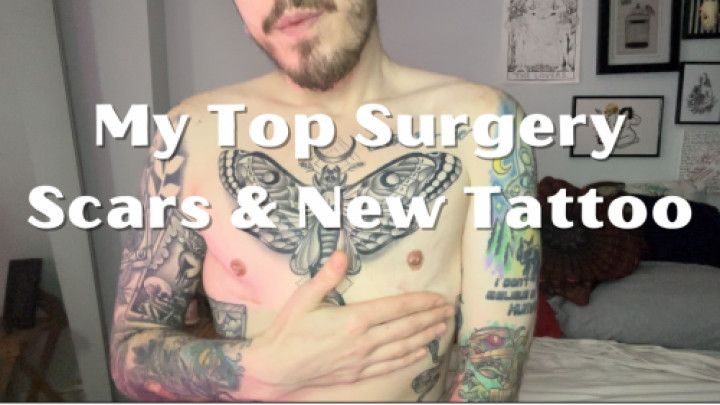 My Top Surgery Scars &amp; New Tattoo