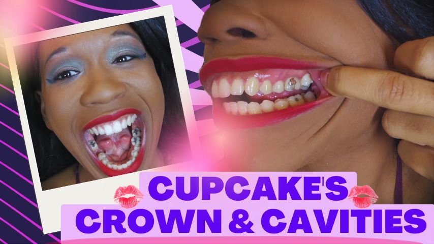 Cupcake's Crown &amp; Cavities