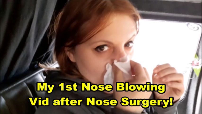 1st Nose Blowing vid after nose surgery