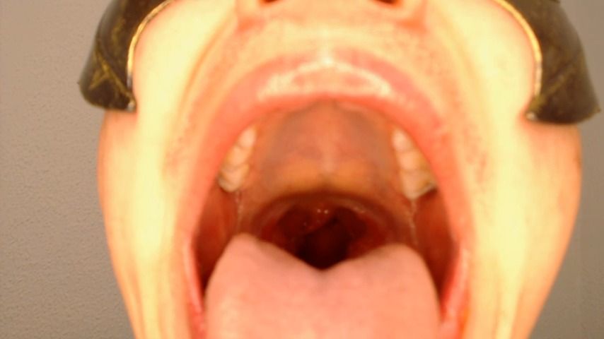 exposure of my big mouth