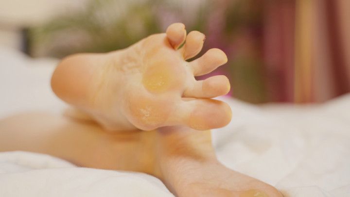 Callused feet resting in bed