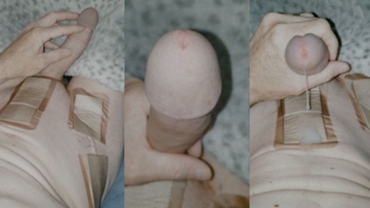 2nd post-surgery masturbation