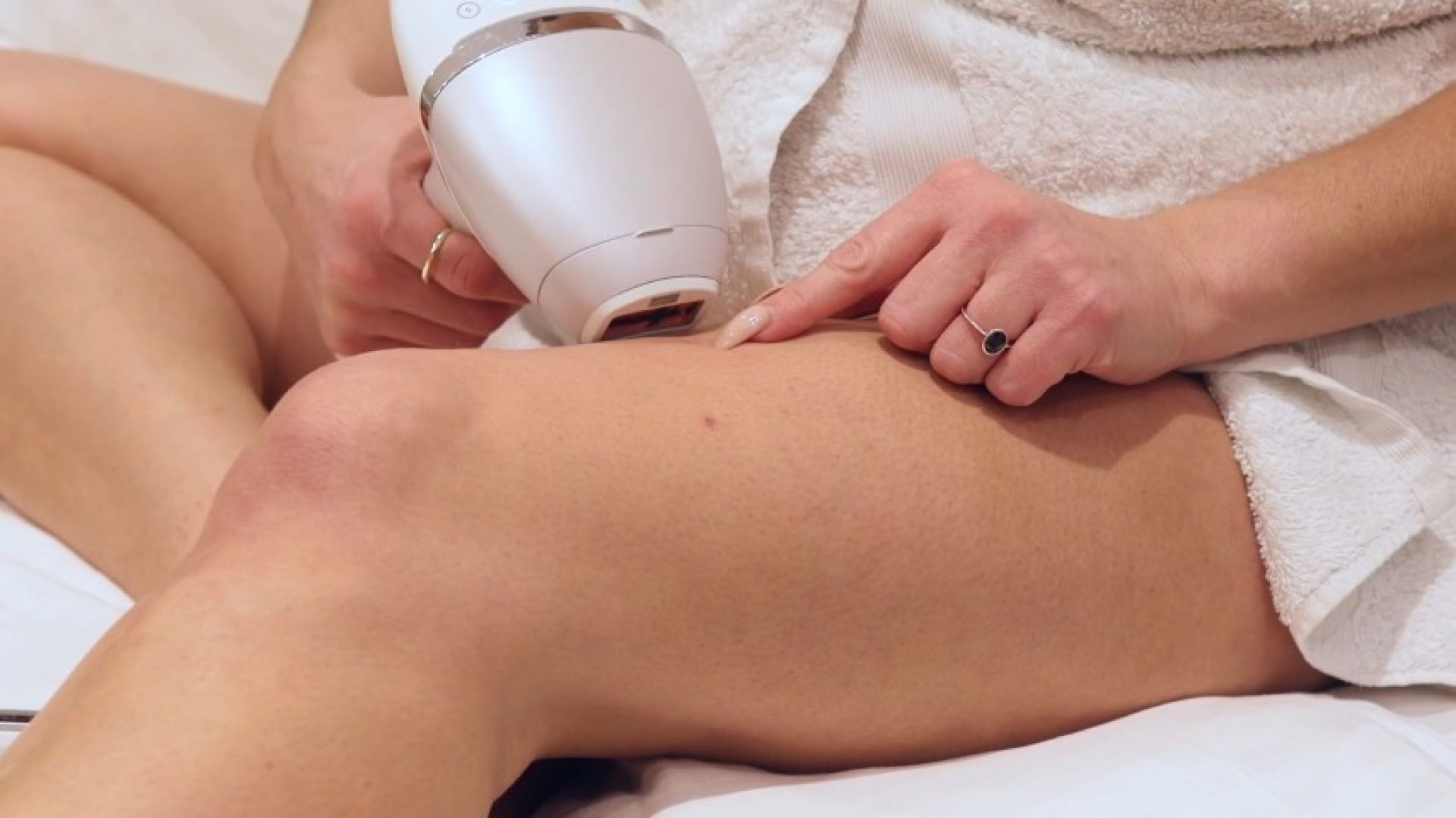 Womanhood 101: Laser Hair Removal