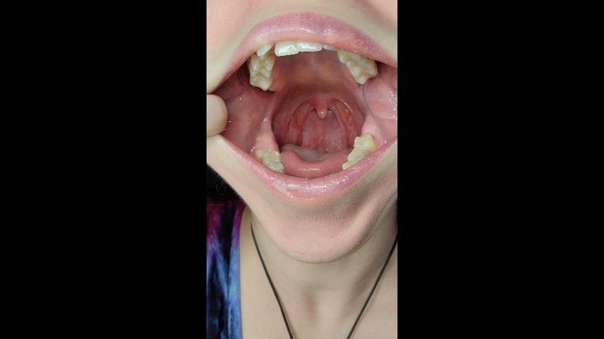 Inside my Mouth