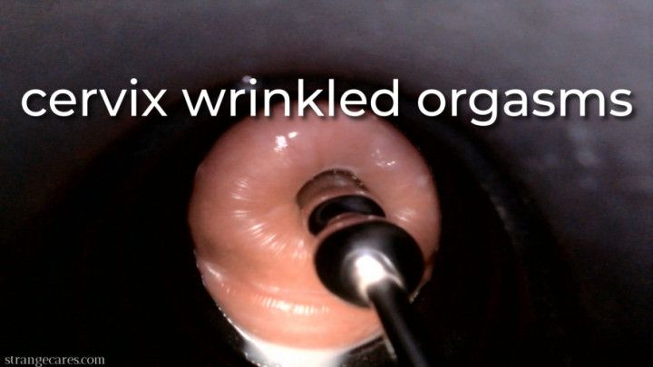 cervix wrinkled orgasms - uncaptioned