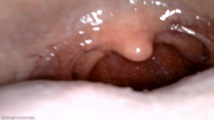 yawning uvula endoscopy