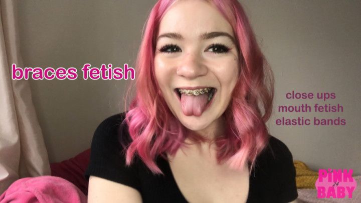 braces fetish