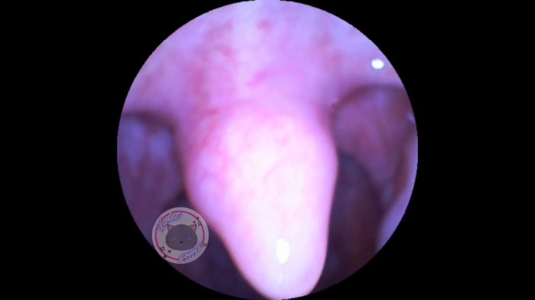 licking and rubbing my uvula on my endoscope