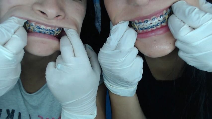 Mouth, teeth, braces inspection