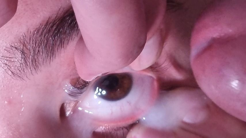 Cumshot into held open eye | close up