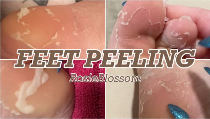 Foot Peel After Foot Mask