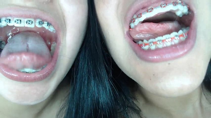 Braces, mouth, uvula fetish