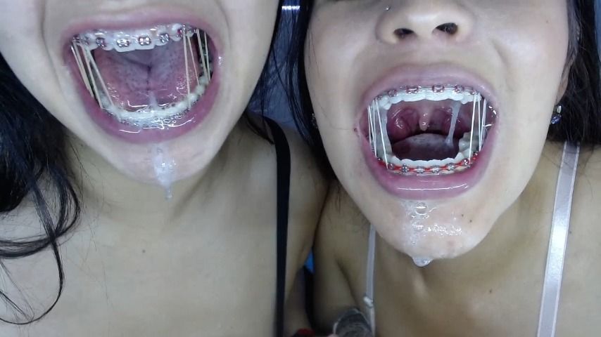 Extreme blowjob with braces
