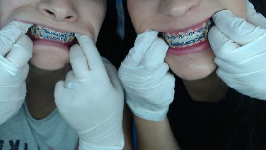 Mouth, teeth, braces inspection