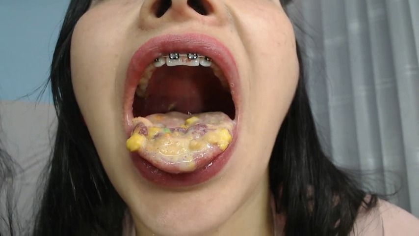 Nasty Cereal Braces