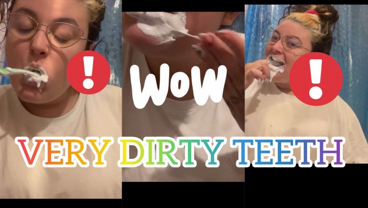 VERY DIRTY TEETH