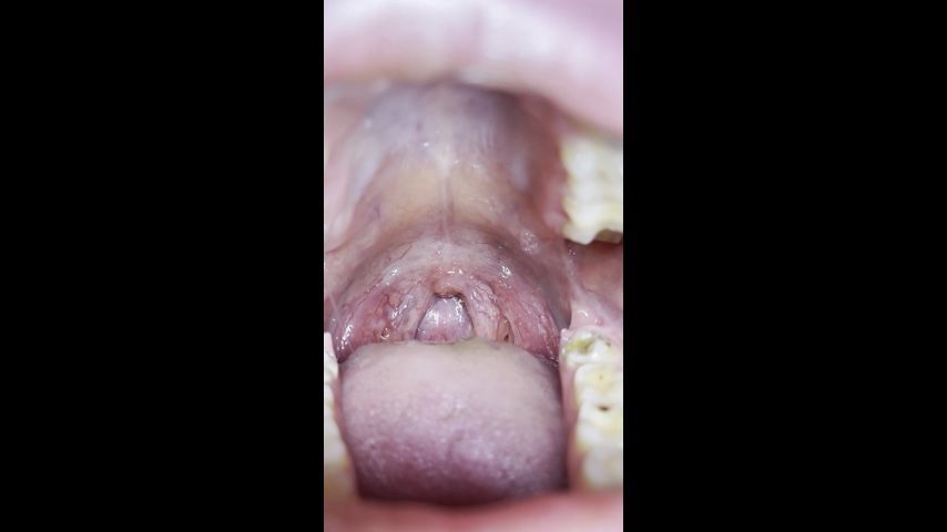 The girl shows her uvula, teeth close-up