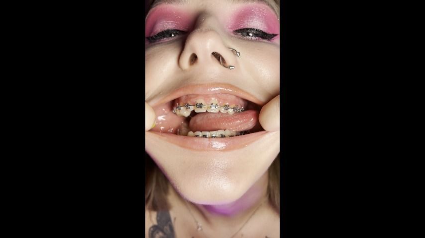 Pink uvula and metal mouth