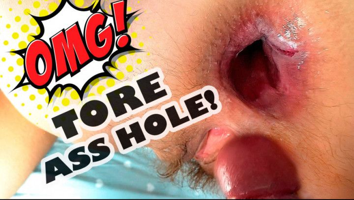 Tore my ass hole.Anal cream pie, FARTING