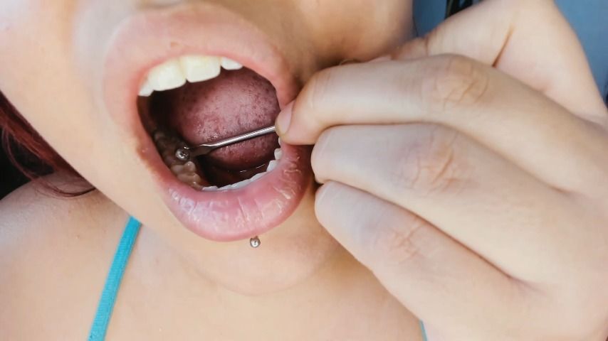 FULL VIDEO MOUTH: SCRAPING, CHECKING