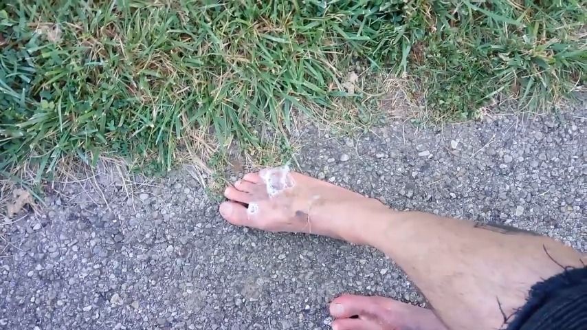 Spit Feet in the Park 3