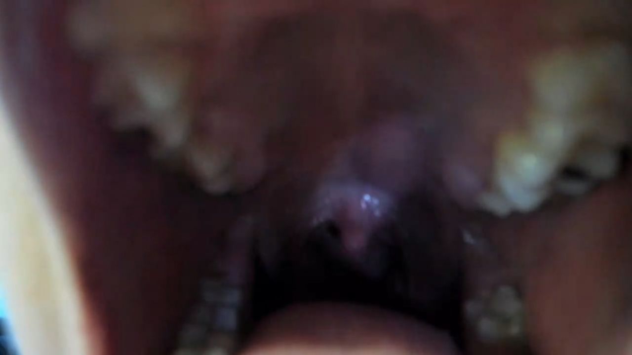 burping close to you + uvula