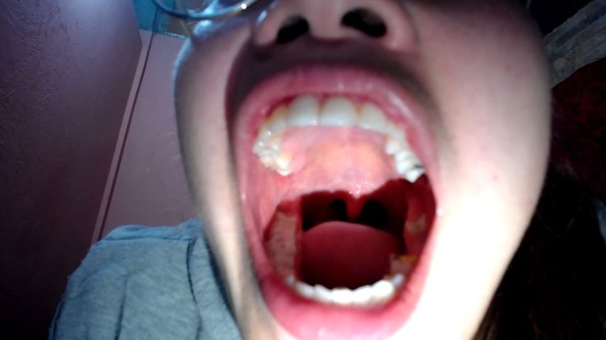 uvula and burping